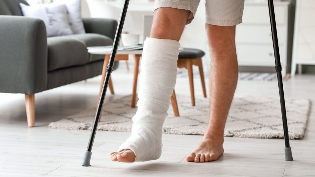 Broken Bones in Car Accidents